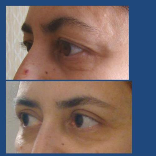 Before after photos of our patients 3